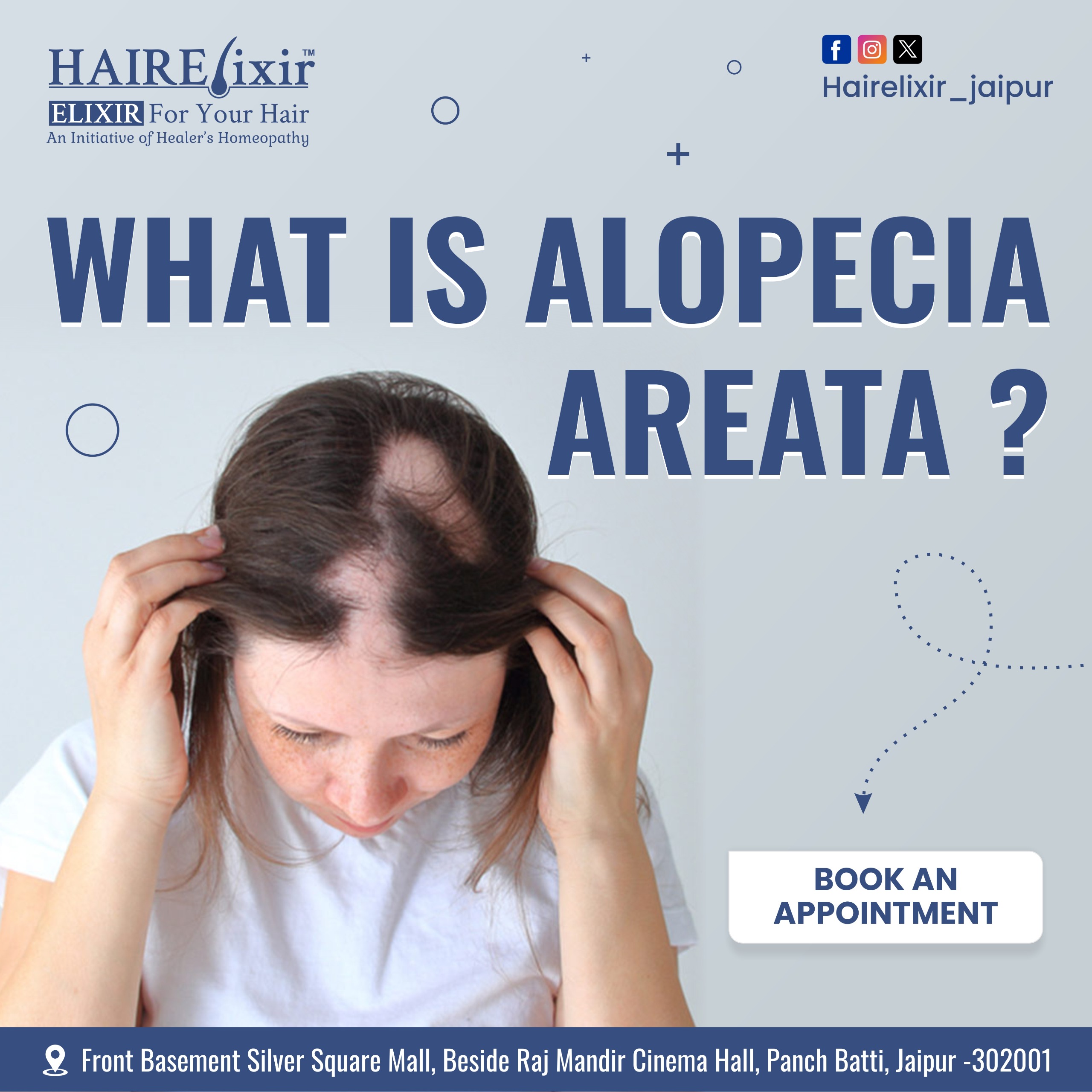 What is Alopecia Areata
