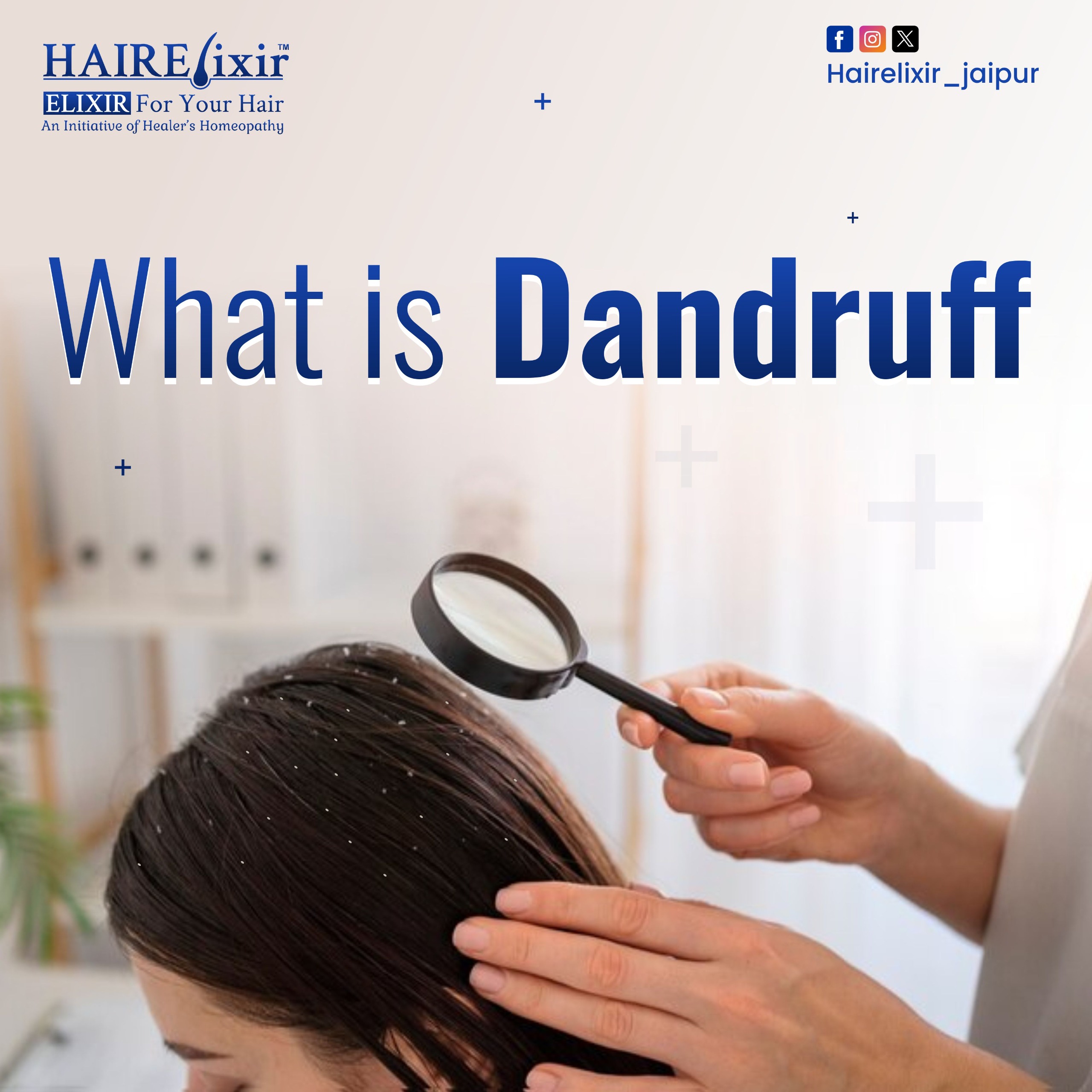 What is Dandruff