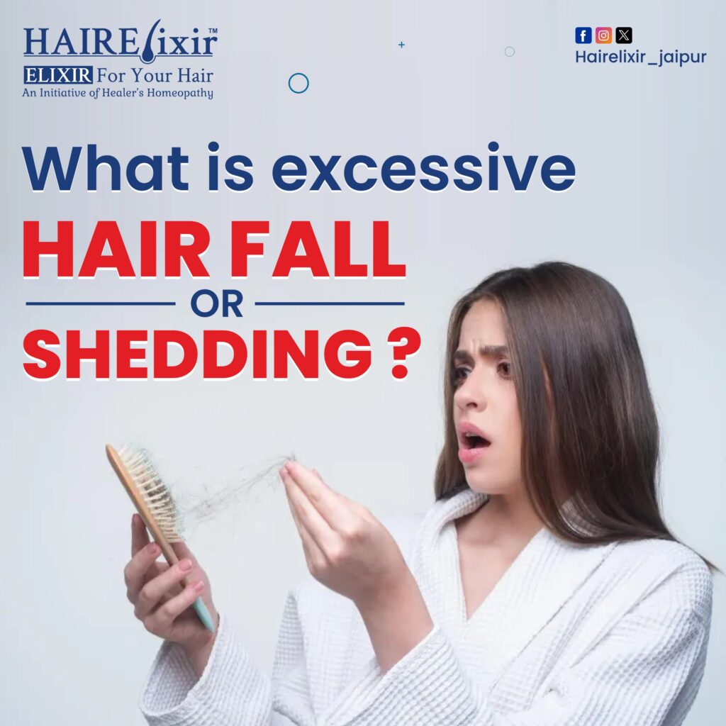 What is excessive Hair fall or shedding