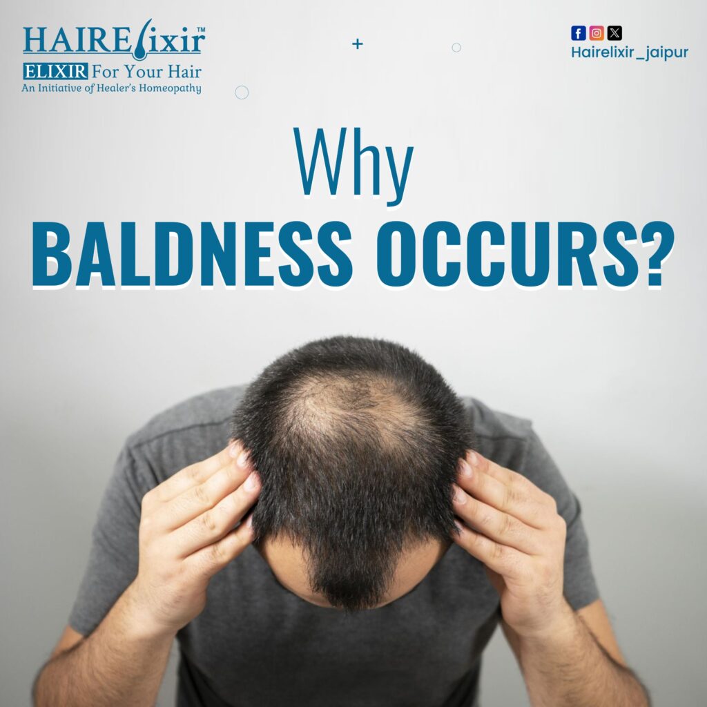 Why Baldness Occurs